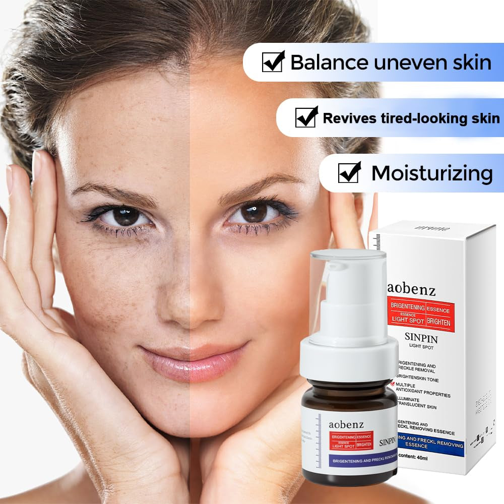 Aobenz Dark Spot Remover for Face & Body | Advanced Corrector Serum for Age, Melasma, Sun, Acne, Black Spots | Tranexamic Acid, Niacinamide Formula for Women & Men | Mild, 1.35 Fl Oz (1PCS)